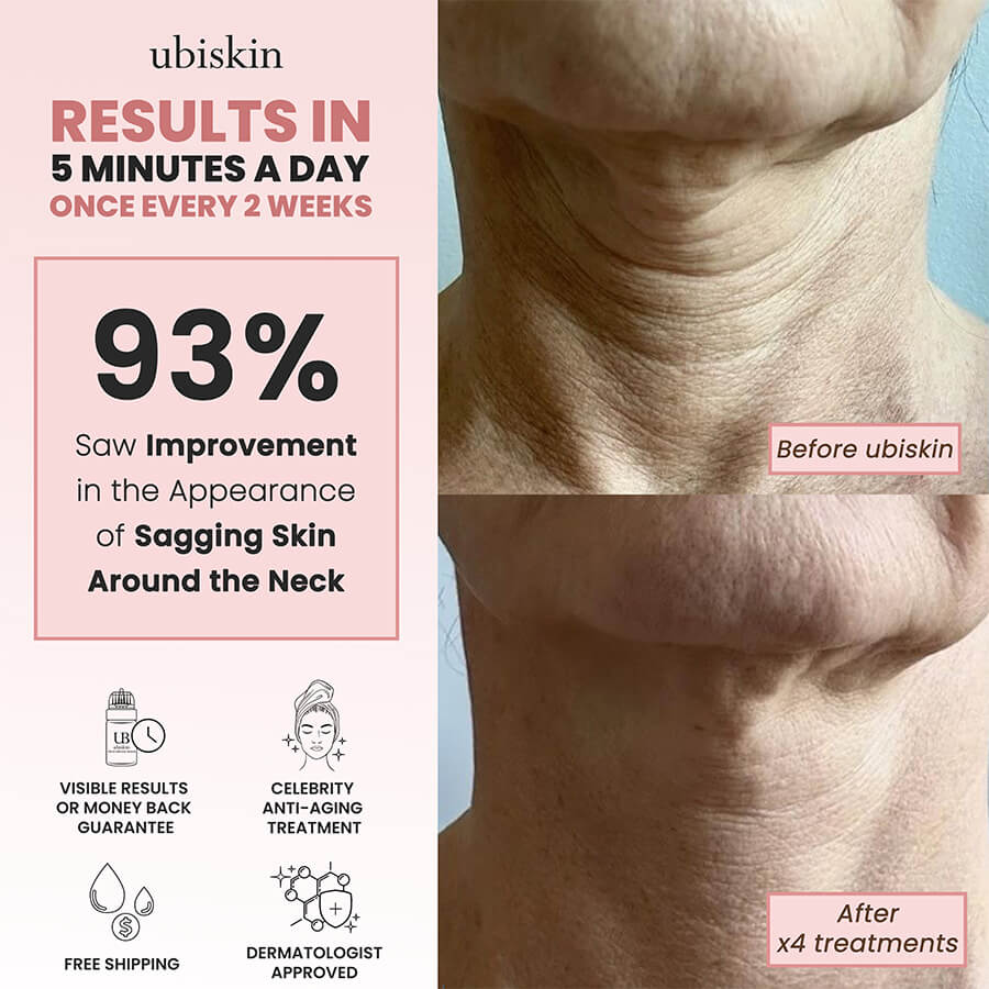 Ubiskin™️ At-Home Rejuvenating Microinfusion System