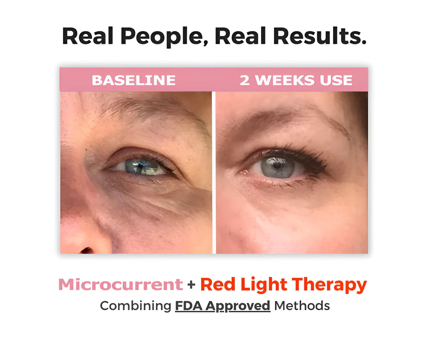 EyeRevive Red Light Therapy